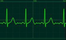 heart beat